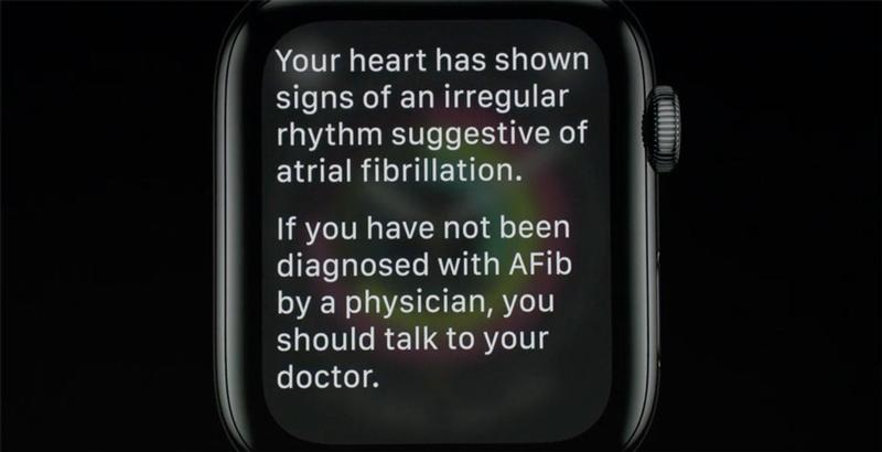 Apple Watch Series 4 vs Series 2: Heart monitoring